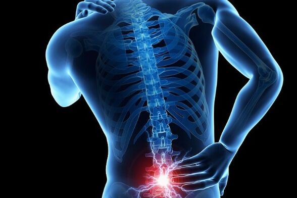 Acute low back pain is a symptom of disc displacement