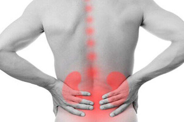 Kidney pathologies can provoke the appearance of pain in the lower back