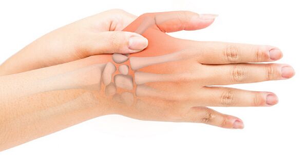Stenosing ligamentitis blocks the finger in a flexed position
