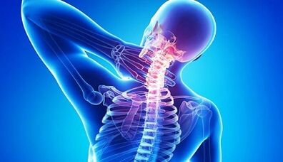 Symptoms and treatment of the neck osteochondrosis