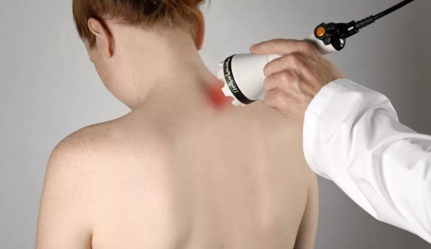 Physiotherapeutic method for the treatment of cervical osteochondrosis