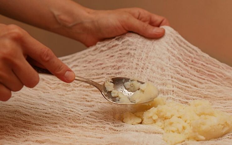 Preparation of a compress of potatoes