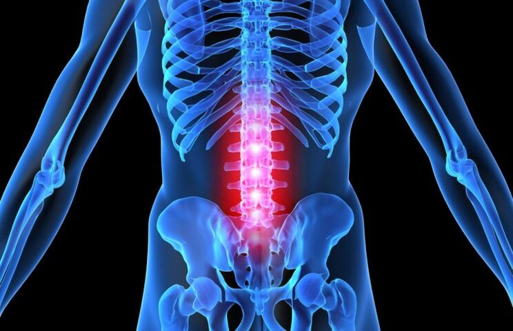 The disease can develop based on many causes