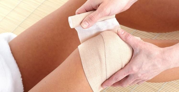 Compress on the knee for arthritis and arthrosis