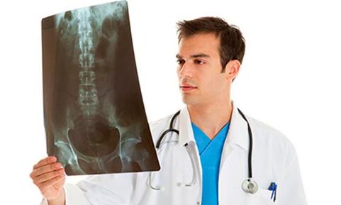 Doctor looking at x-rays to diagnose lower back pain